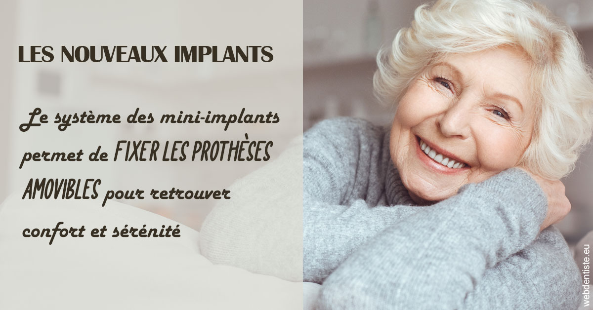 https://www.espace-dentaire-wambrechies.fr/Les nouveaux implants 1