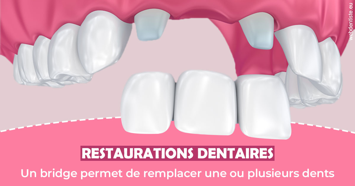 https://www.espace-dentaire-wambrechies.fr/Bridge remplacer dents 2