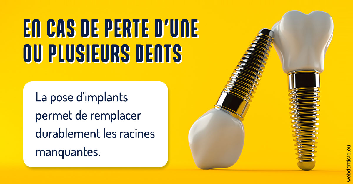 https://www.espace-dentaire-wambrechies.fr/2024 T1 - Implants 02
