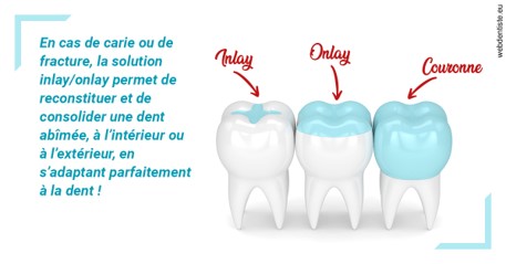 https://www.espace-dentaire-wambrechies.fr/L'INLAY ou l'ONLAY