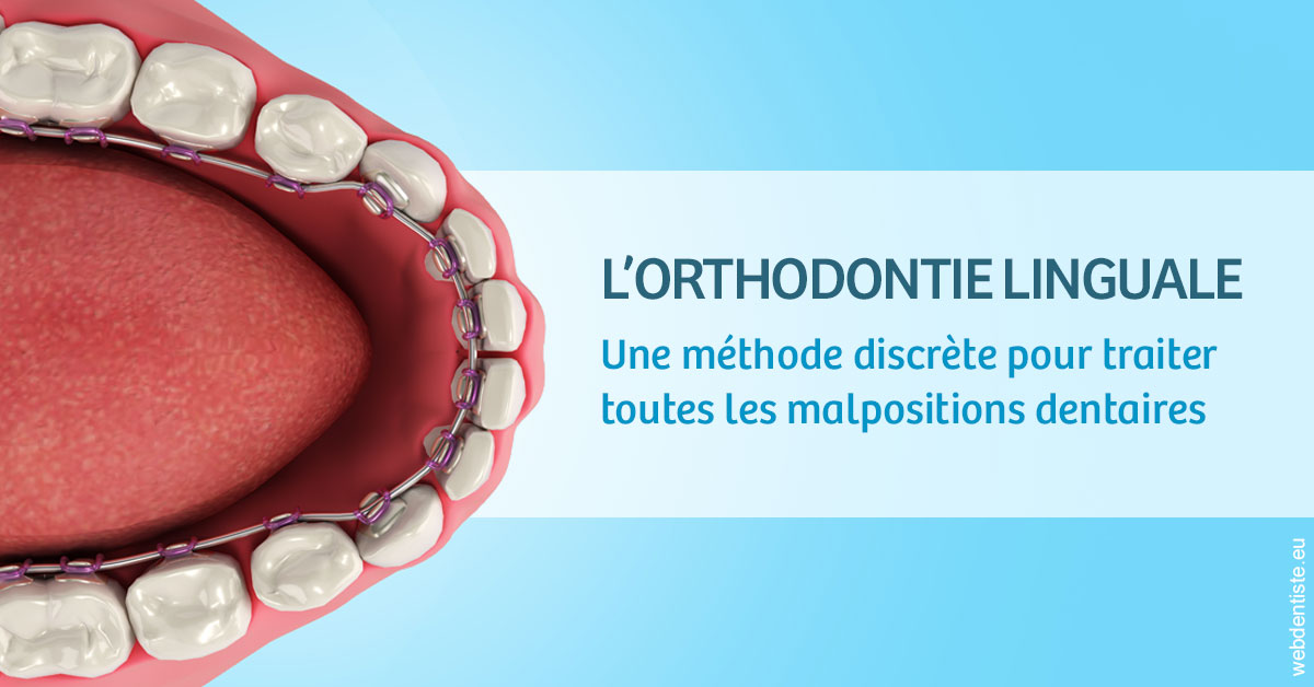 https://www.espace-dentaire-wambrechies.fr/L'orthodontie linguale 1