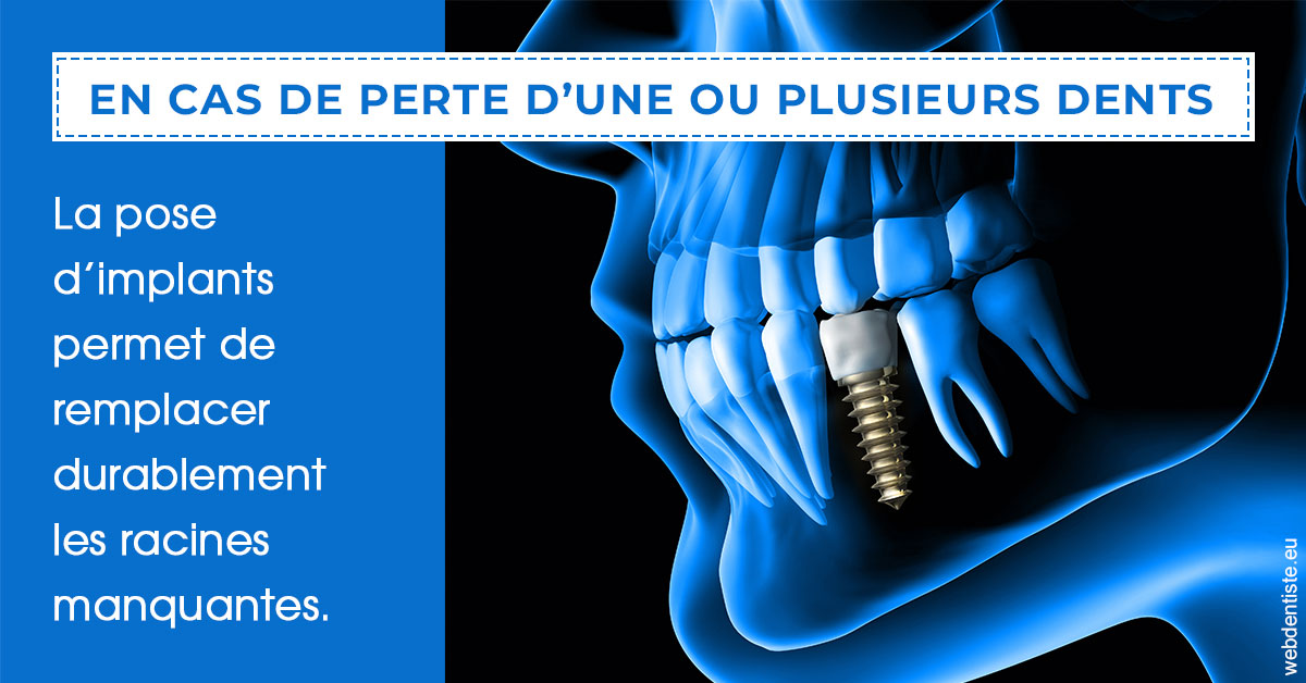 https://www.espace-dentaire-wambrechies.fr/2024 T1 - Implants 01