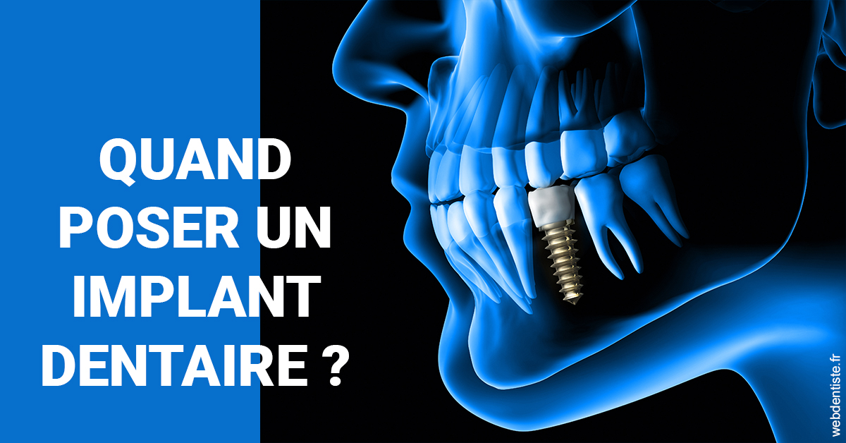 https://www.espace-dentaire-wambrechies.fr/Les implants 1