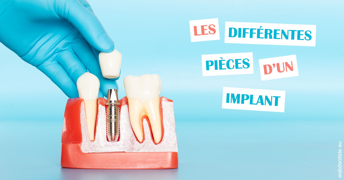 https://www.espace-dentaire-wambrechies.fr/Les différentes pièces d’un implant 2