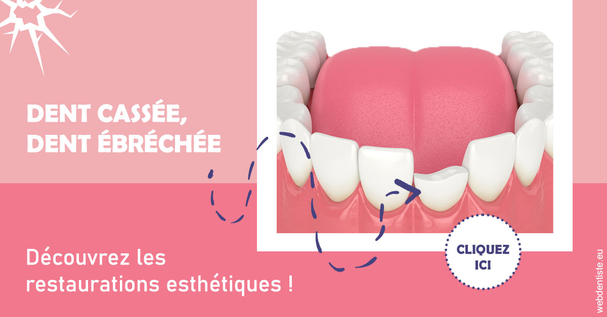 https://www.espace-dentaire-wambrechies.fr/Dent cassée ébréchée 1