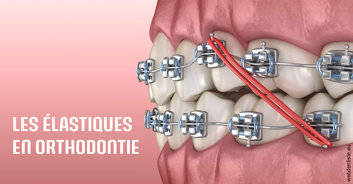 https://www.espace-dentaire-wambrechies.fr/Elastiques orthodontie 2