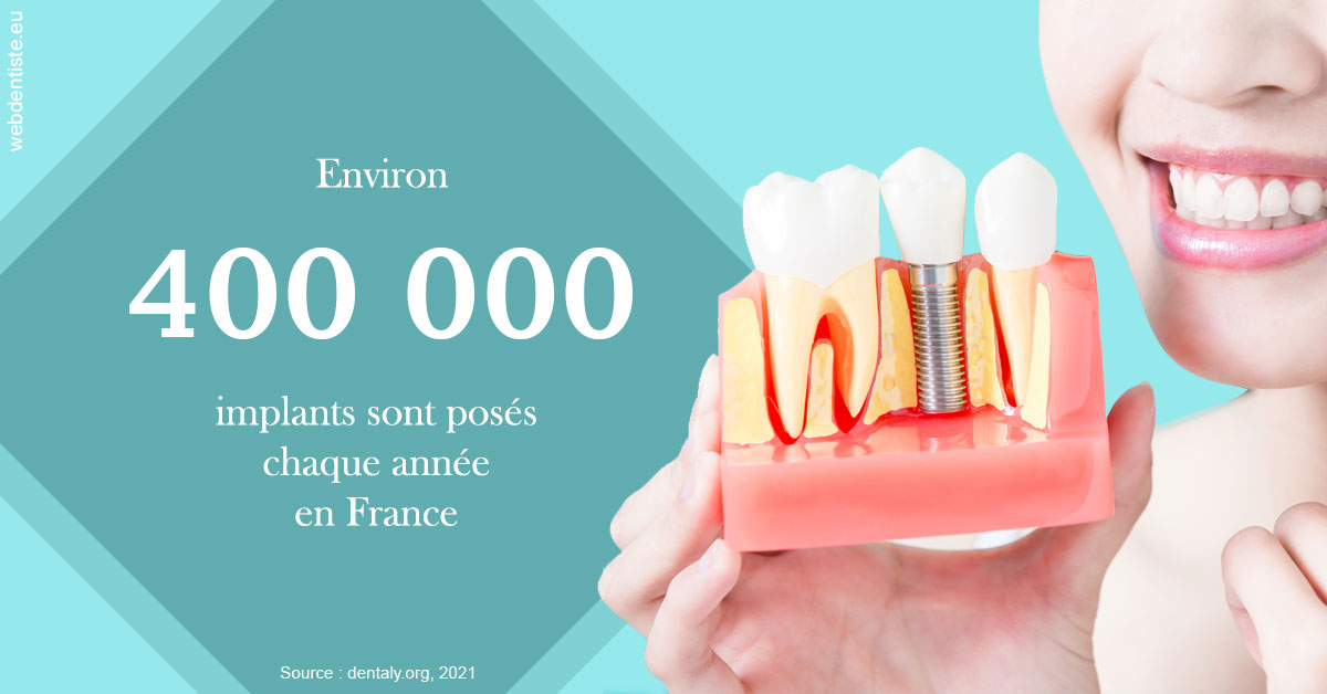 https://www.espace-dentaire-wambrechies.fr/Pose d'implants en France 2