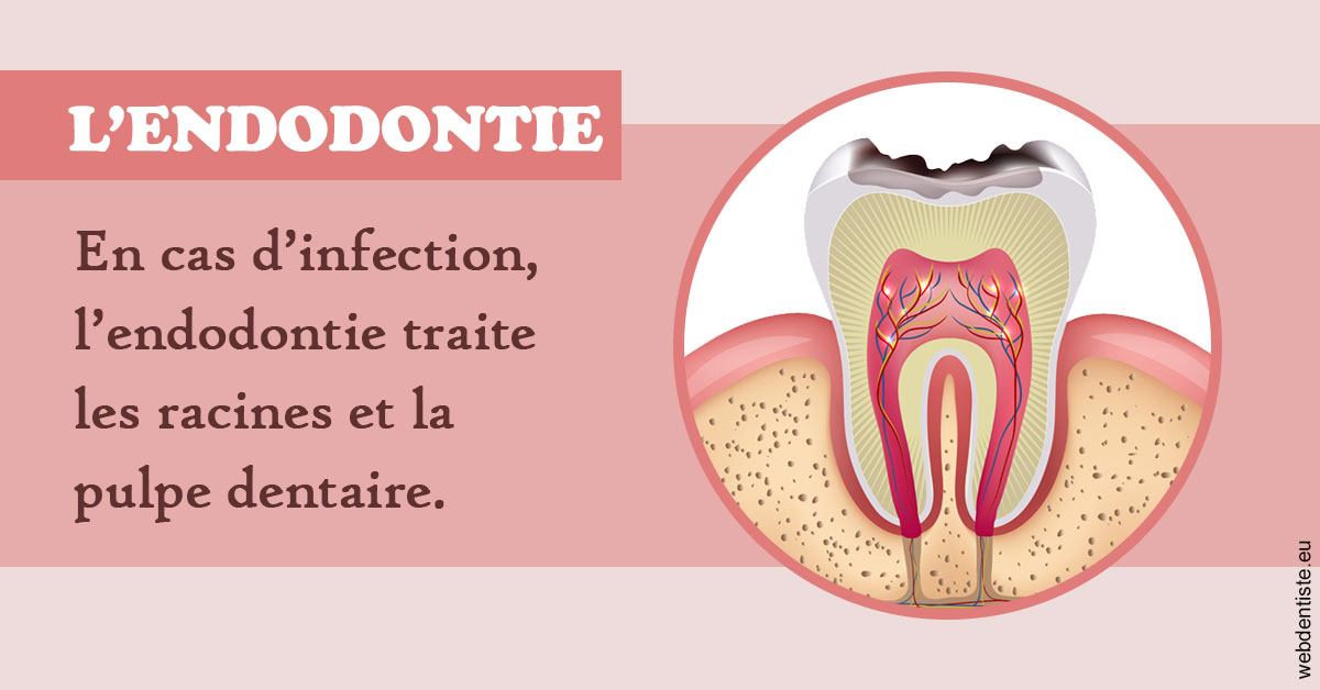 https://www.espace-dentaire-wambrechies.fr/L'endodontie 2