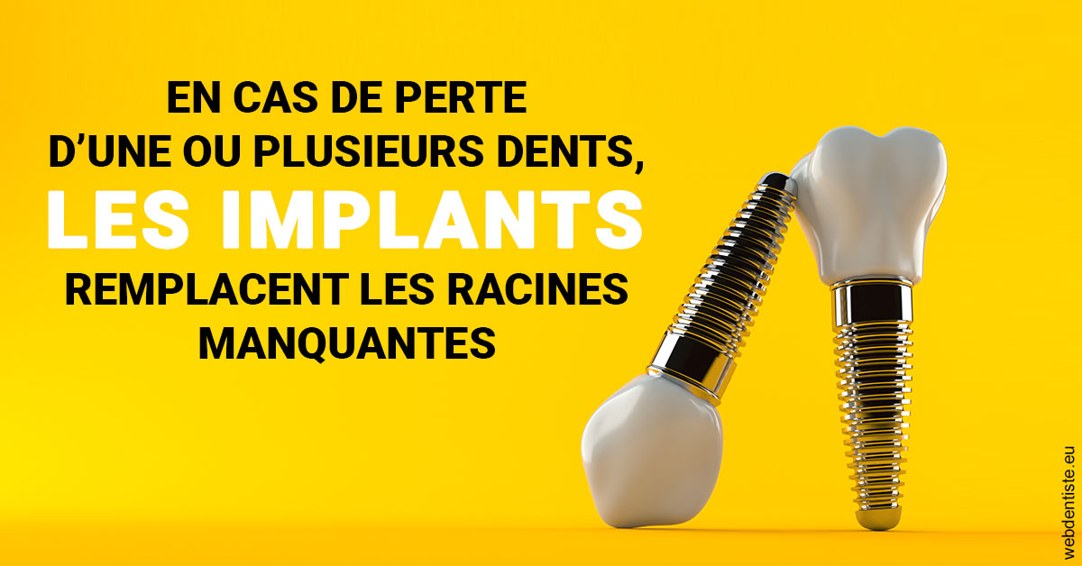 https://www.espace-dentaire-wambrechies.fr/Les implants 2